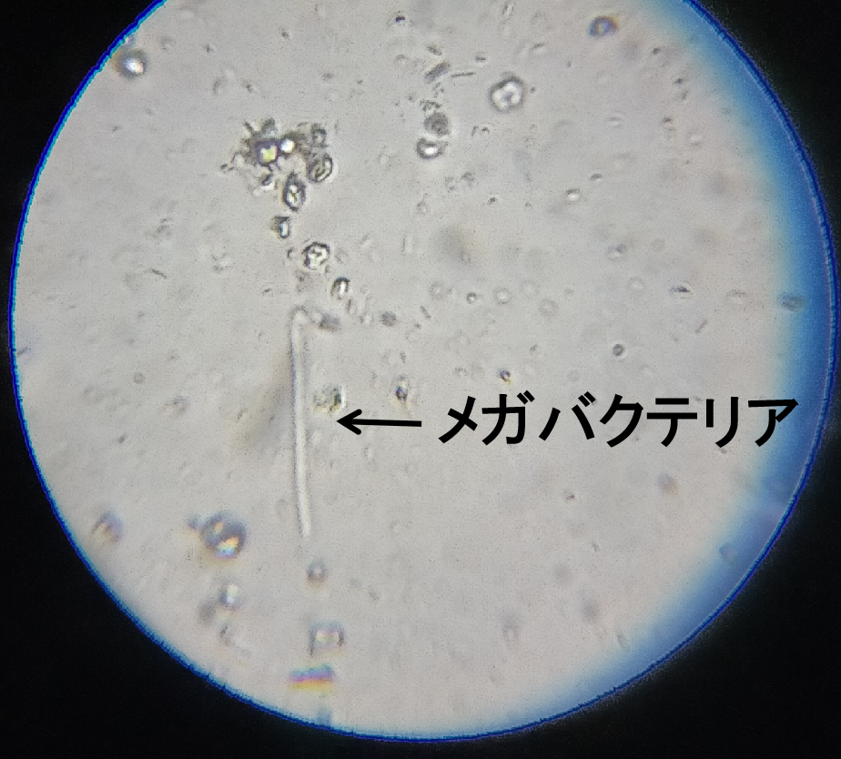 メガバクテリア画像　顕微鏡写真